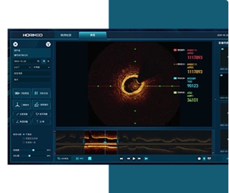 恒宇醫(yī)療OCT系統(tǒng)醫(yī)療影像軟件界面設(shè)計(jì)